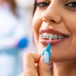 The Best Age For Braces Might Be Older Than You Think