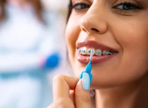 The Best Age For Braces Might Be Older Than You Think